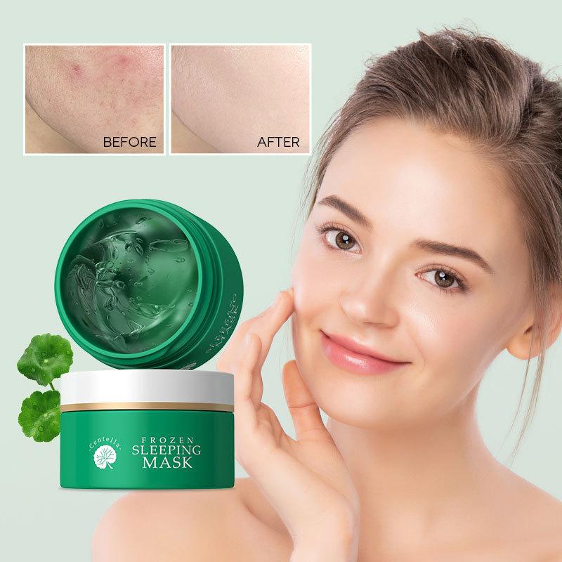 Centella Asiatica Acne Face Cream Pimple Marks Removal Oil Control Moisturizing Pockmark Smooth Facial Creams Skin Care Products