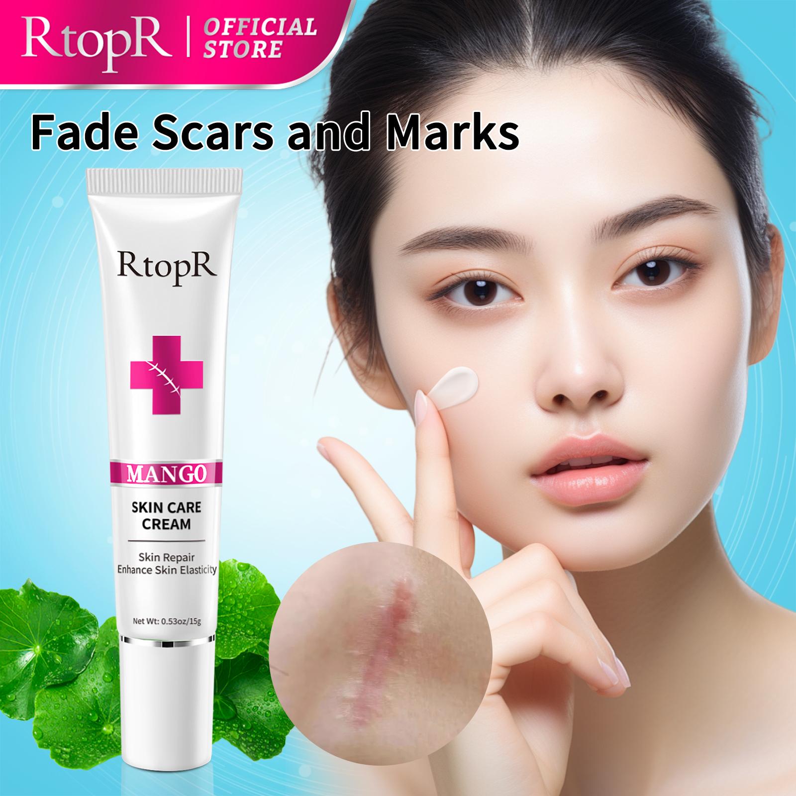 RtopR Krém na odstranění akné Skin Repair Face Cream Krém na bělení akné na skvrny po akné