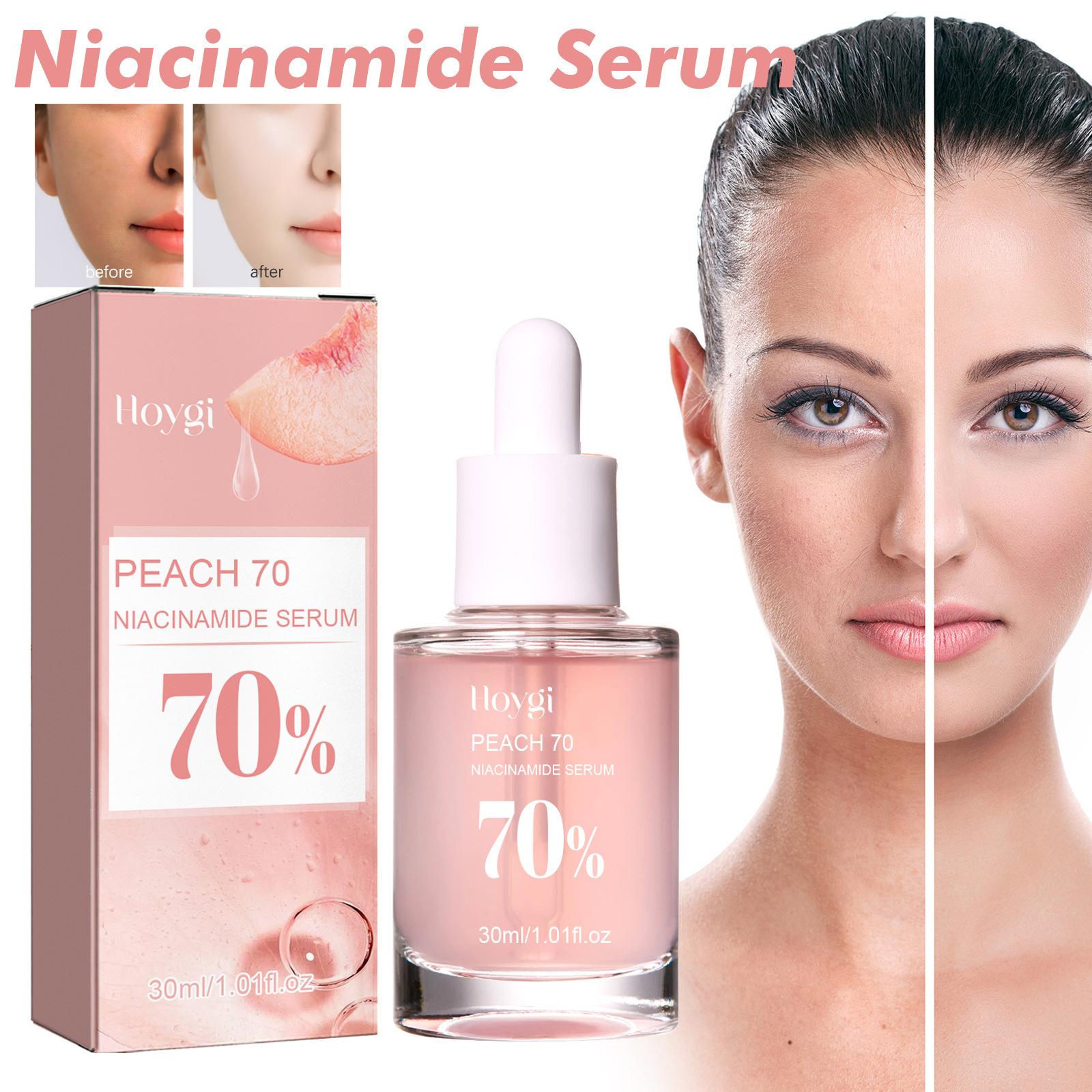30ml Niacinamide Serum Melanin Removal Fade Melasma Dark Spots Corrector Shrink Pores Hyaluronic Acid Moisturizing Skin Care