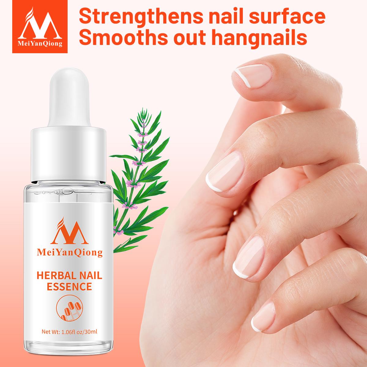 MeiYanQiong Nail Repair Nail Feet Care Essence Nail Foot Whitening Toe Nail Removal Gel
